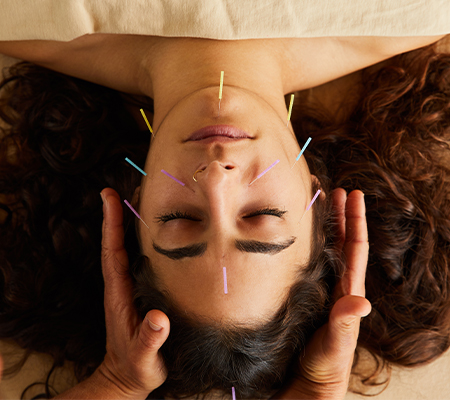 Image of woman getting accupuncture
